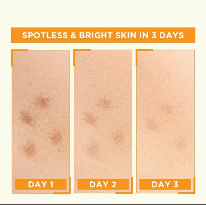 Skin Brightening Vitamin C Serum